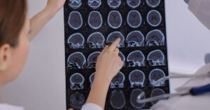 Living with Multiple Sclerosis: How Rehabilitation Can Improve Your Quality of Life